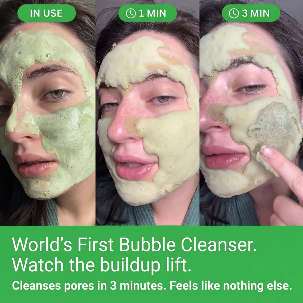 Winston™ Basil Bubble Mask